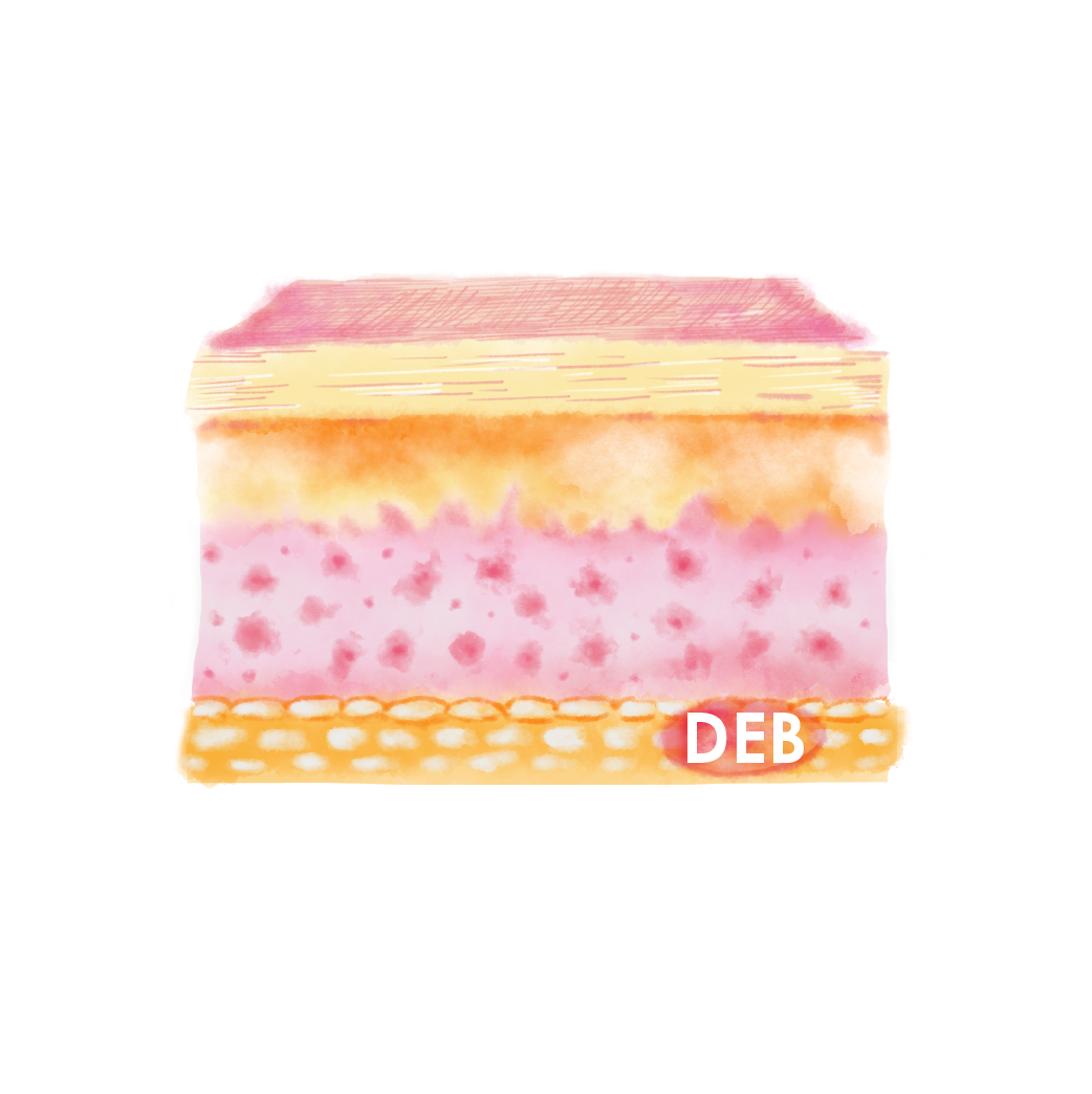 deb-layer-image